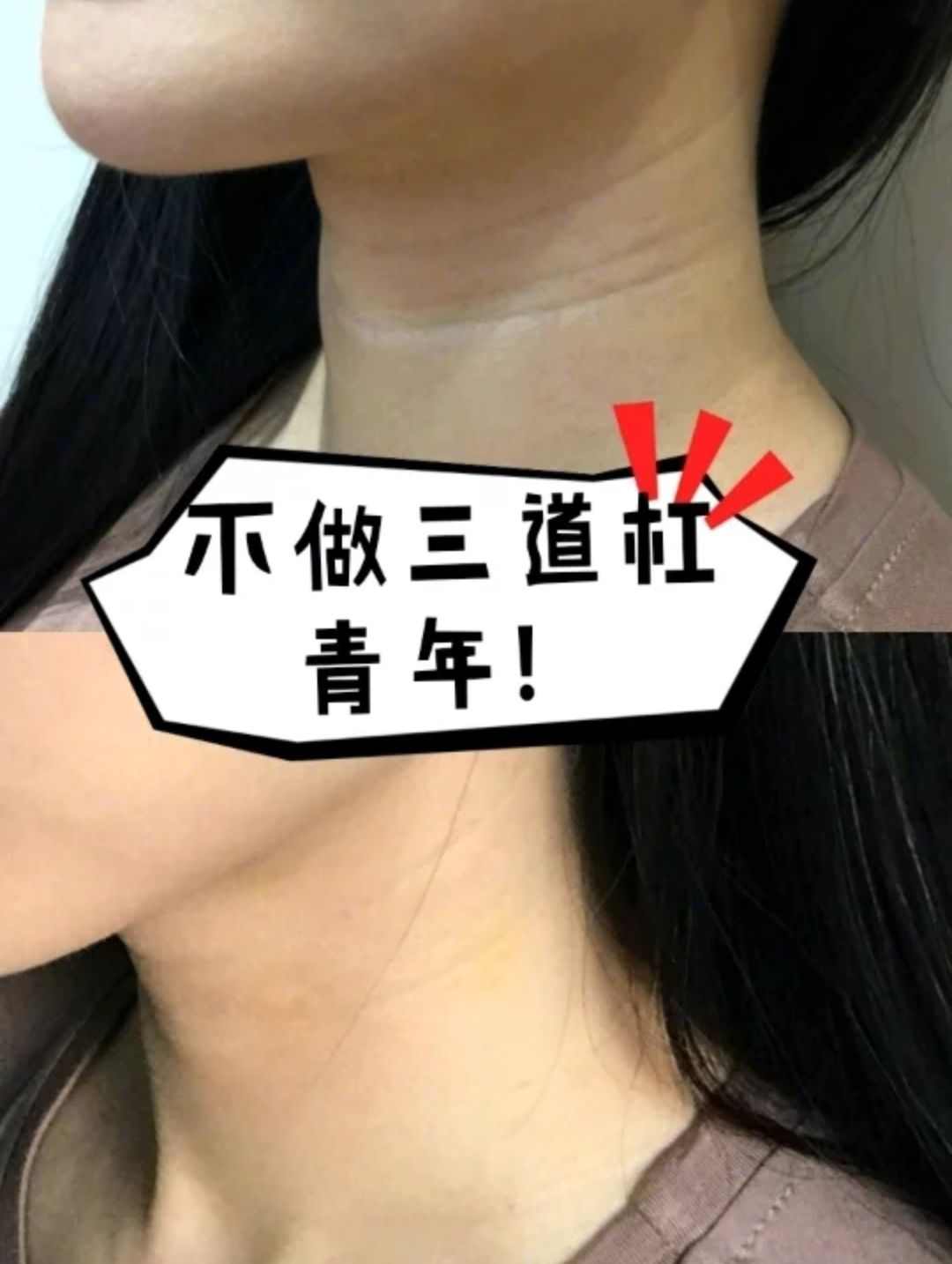 80的脖子有颈纹在线求江疏影无痕天鹅颈养成秘诀