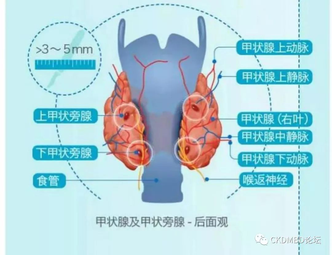 甲状旁腺大小图片