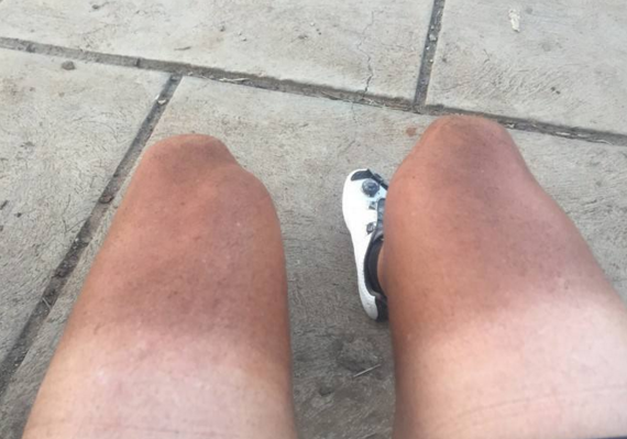 为啥在城市不易被太阳晒黑回农村没几天皮肤被变黑了