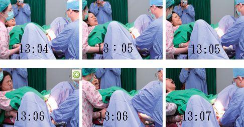 原创顺产的痛点到底在哪里看完全过程后就了解了女人的不容易