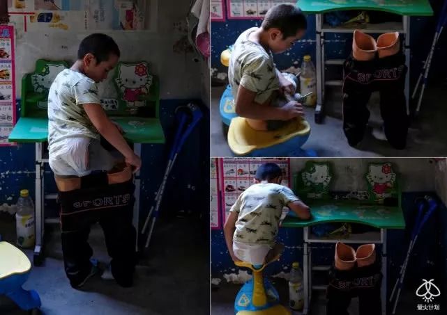 马路遥拍无腿男孩跳舞视频点击过亿萤火演讲