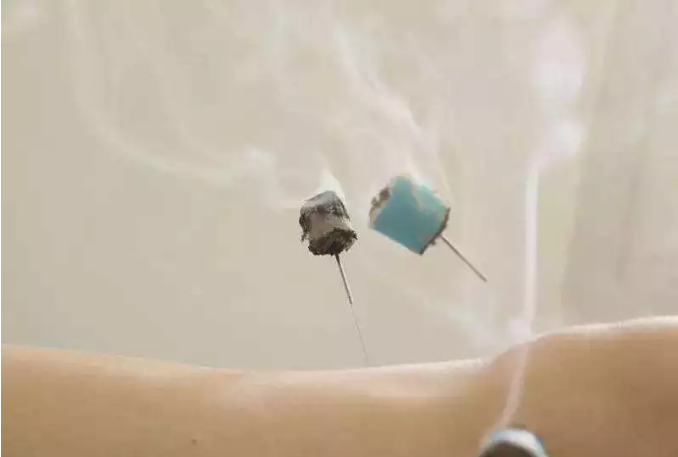 建标病集温针一出腰腿痛关节风湿各类痹症