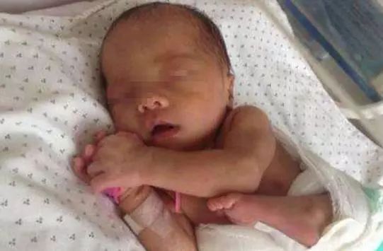 婆婆逼迫产妇喝转胎药,孩子出生,家人吓坏了