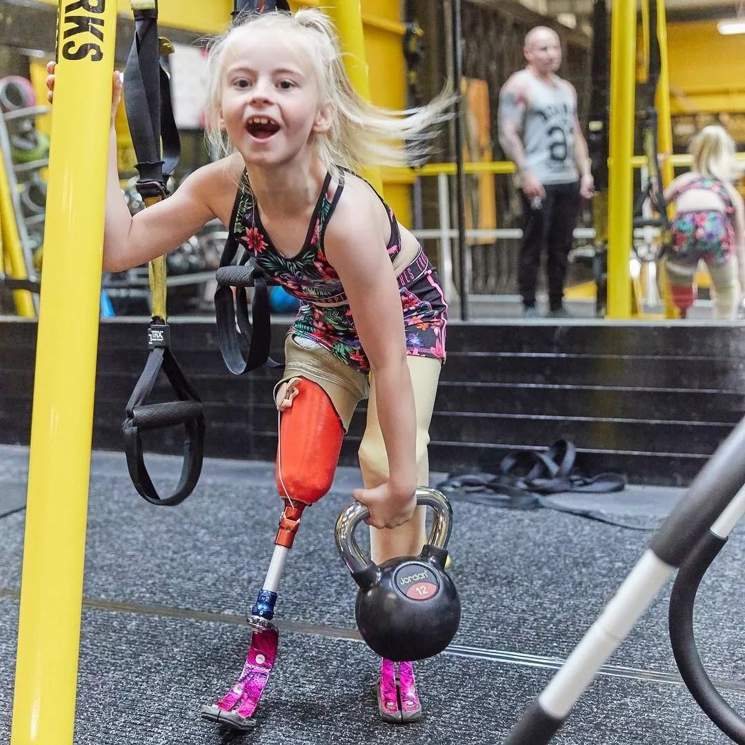 无腿模特火遍纽约巴黎时装周不认命的女孩才最美