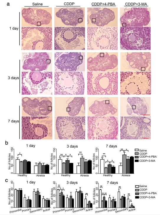 4-pba和3-ma对cddp处理小鼠卵巢组织学的影响4-pba和3-ma对cddp处理