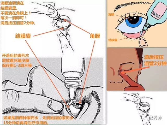 按压鼻泪管图片