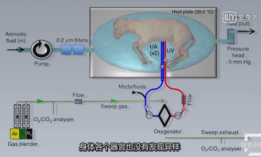 人造子宫的问世早产儿会有更多的希望