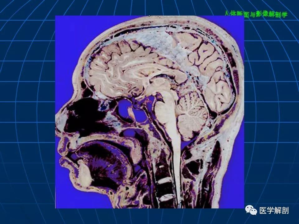 颅脑大体断层解剖(矢状位)