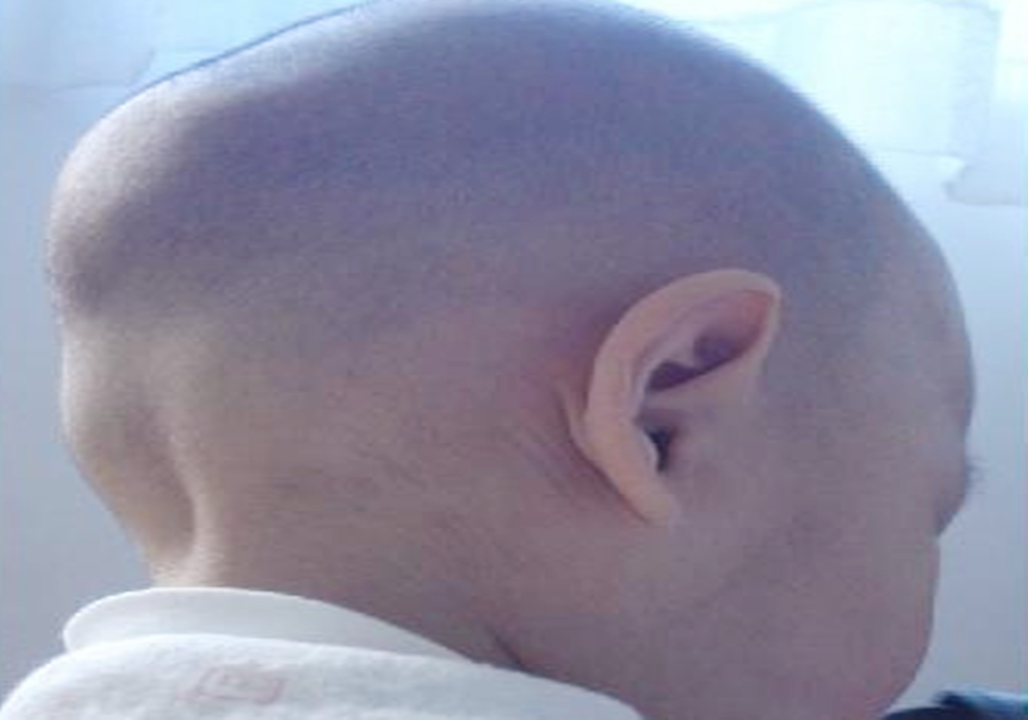 妈为啥我是大扁头毁颜值的事情别再干了孩子长大后会埋怨