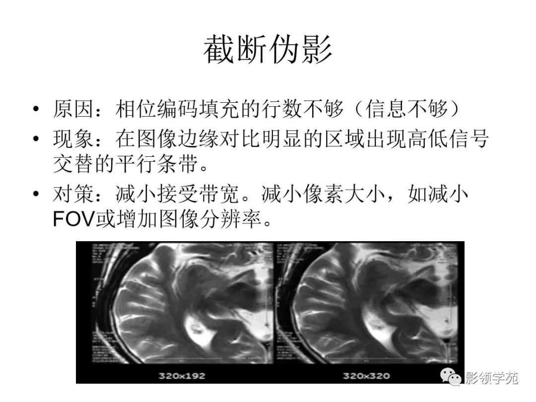 常見mr偽影及對策