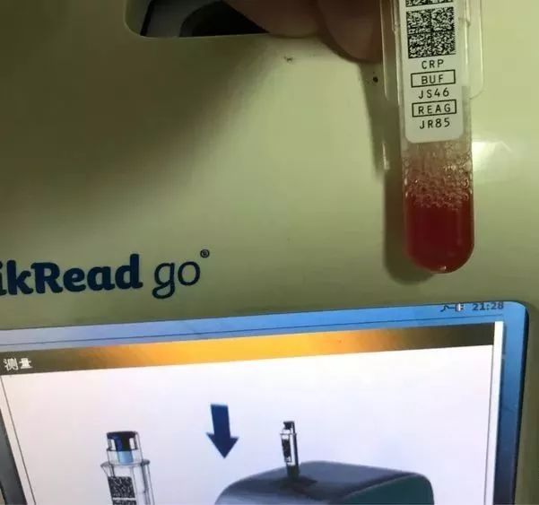 各位医生要注意血常规检查别忽略了mchc