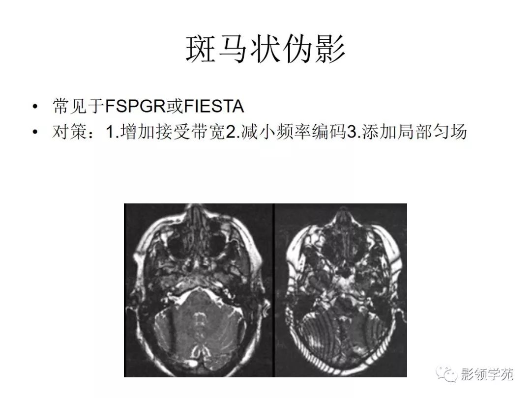 常見mr偽影及對策