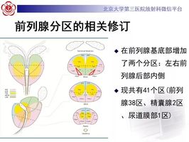 前列腺分区图解图片