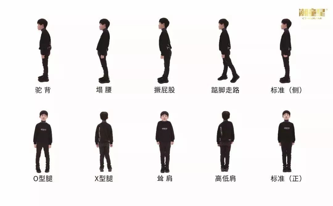 形体训练可以纠正孩子发育过程中的不良体态,如扣肩,含胸,驼背,塌腰,o