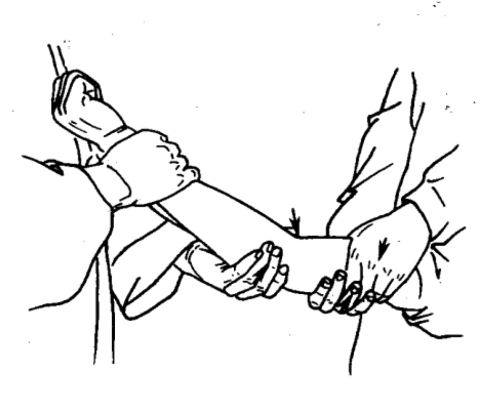 何为正骨诀窍2个观点告诉您正骨诀窍是重在摸骨还是正筋