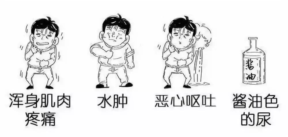 的同时也可能会有一些担惊受怕的经历,比如出现了酱油色尿,肌肉疼痛