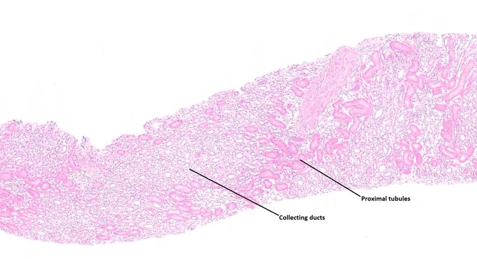 肾小管间质之皮质 