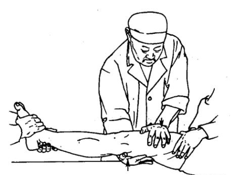 有筋出槽则必有骨错缝,有骨错缝则必有筋出槽但要真正学会摸筋摸骨