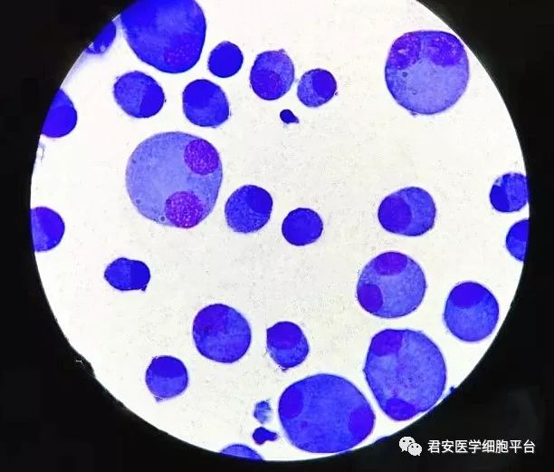 真实与谎言仪器法胸水白细胞计数增高引发的思考