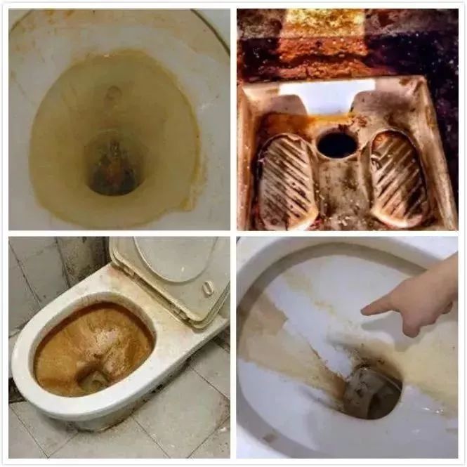而且,不管你冲厕所有多及时,时间久了,马桶上总会有一层恶心的黄垢.
