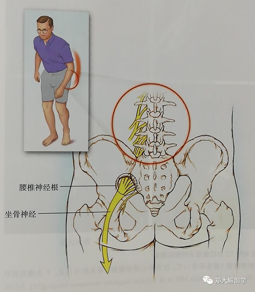 六种引起腰椎和骶髂关节的疼痛综合征