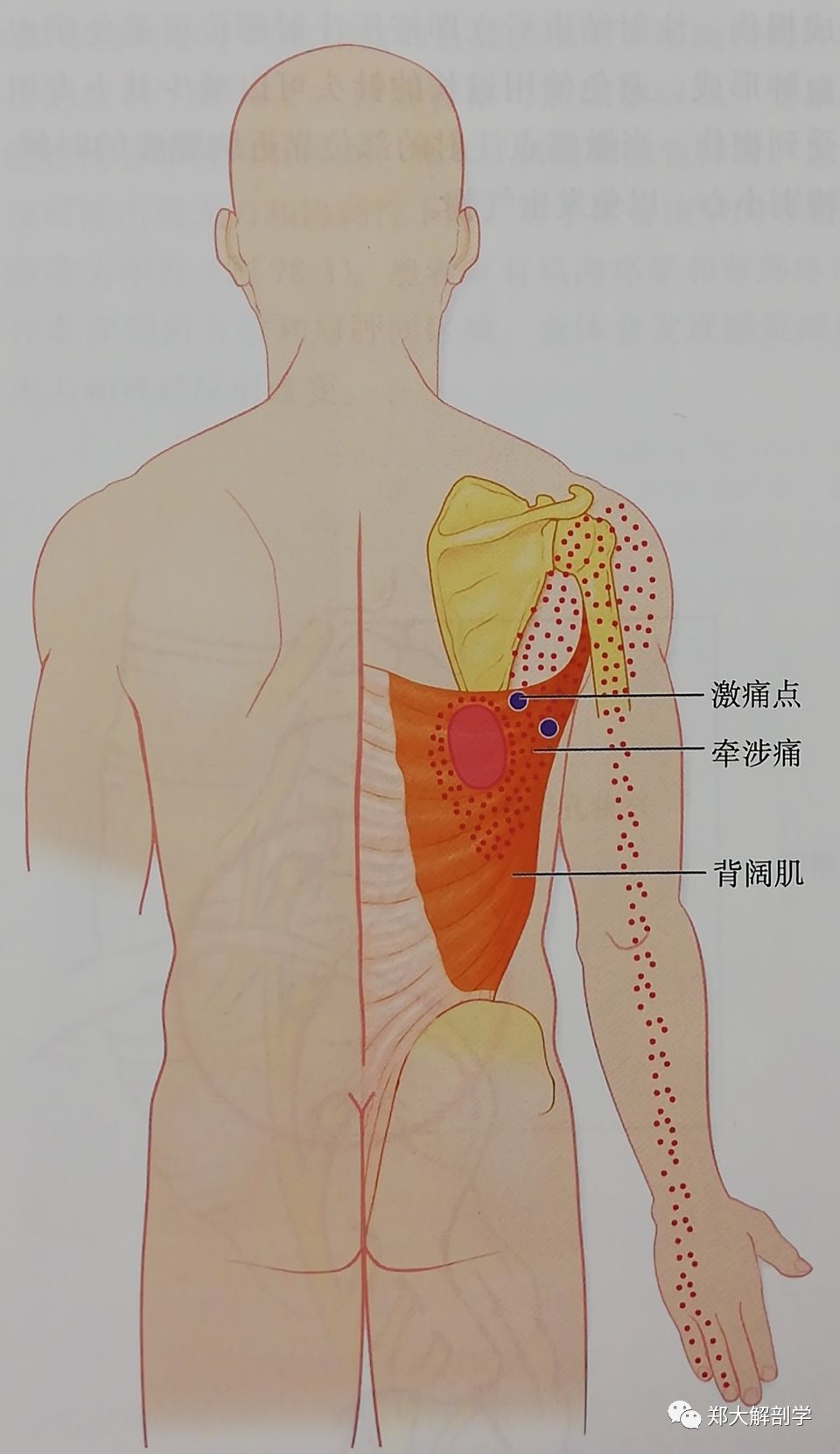 六种引起腰椎和骶髂关节的疼痛综合征