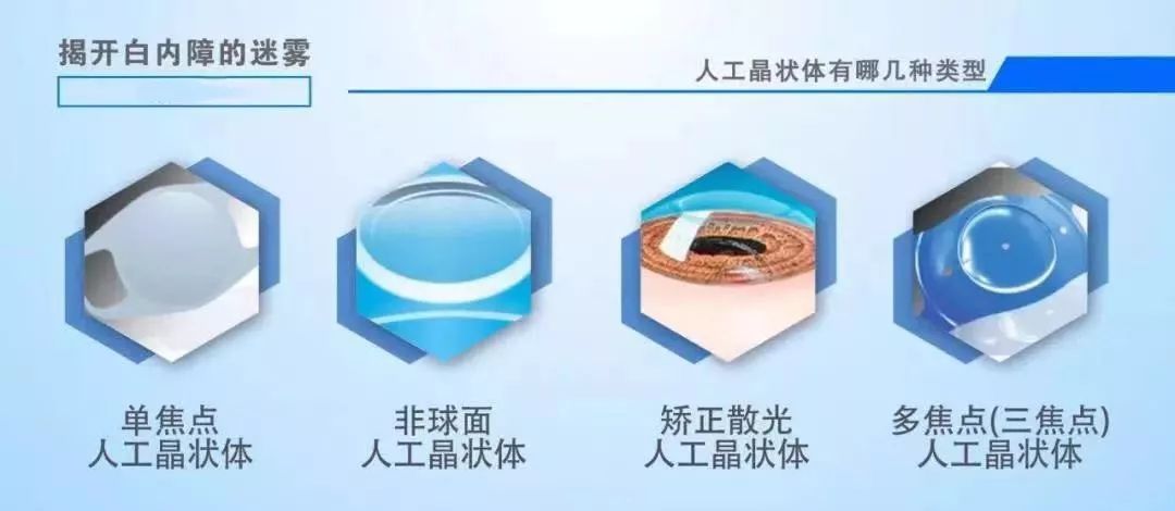 新型人工晶状体包括非球面人工晶状体,散光矫正型人工晶状体,多焦点