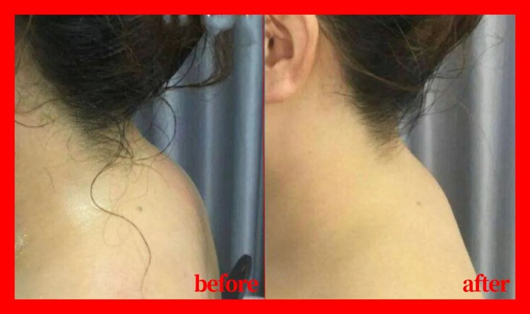 赵雅芝65岁的背影宛若少女这个部位肥厚的女人才是真大妈