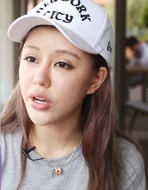 天然女神为渣男整容30多次变胶样你们不要像我一样傻