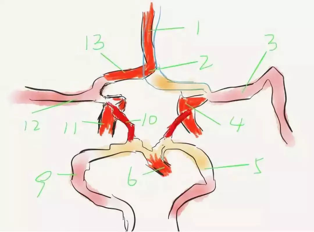 图 6 大脑动脉环(willis 环)1:大脑前动脉;2:前交通动脉;3:左大脑中