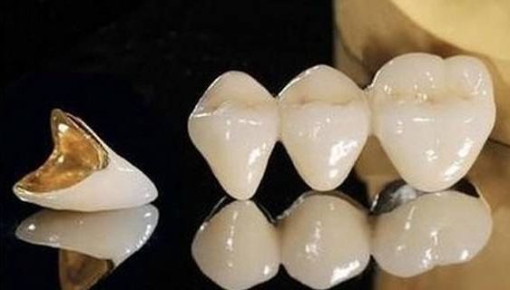 根管治疗后牙齿已经不疼了,为什么还要戴牙冠呢?