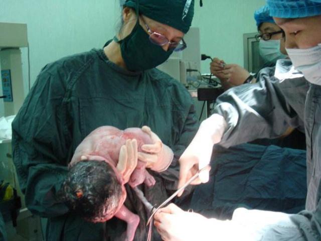 剪脐带的一瞬间究竟是妈妈疼还是宝宝疼答案你可能想不到