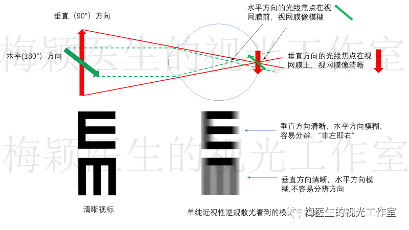 00dc×90(我们称为单纯近视性逆规散光),则水平方向的光线成像在