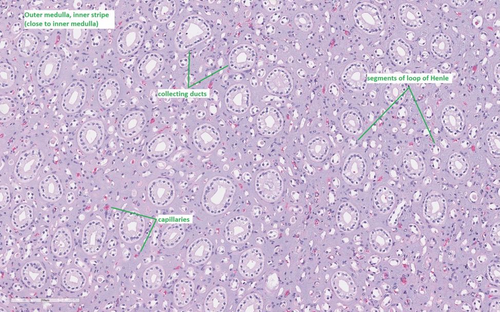 肾皮质和肾髓质切片图片