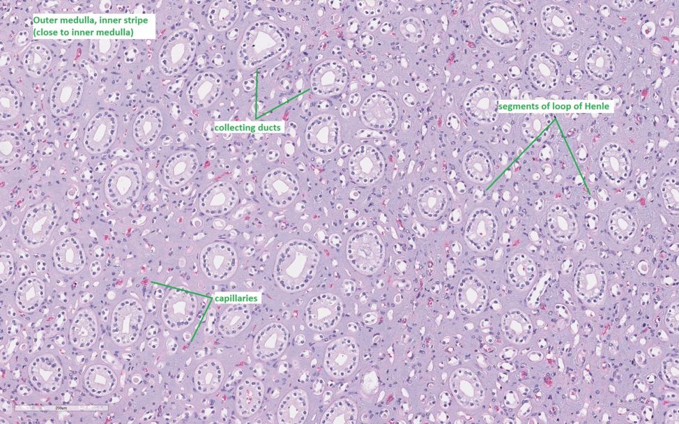 正常肾组织切片图解图片