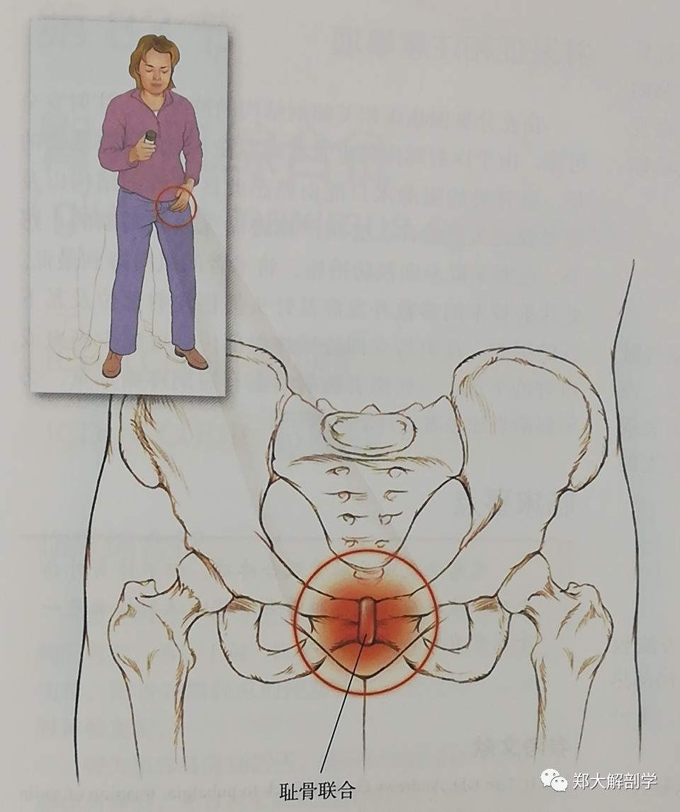 查体可见耻骨联合有压痛点,触诊耻骨联合时疼痛可放射至大腿内侧面