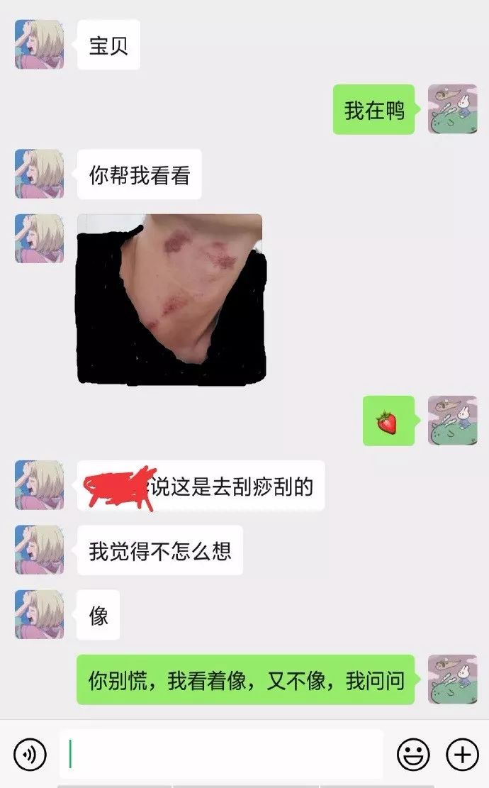 男朋友脖子上多了几个奇怪的「吻痕」,他说那是刮痧?