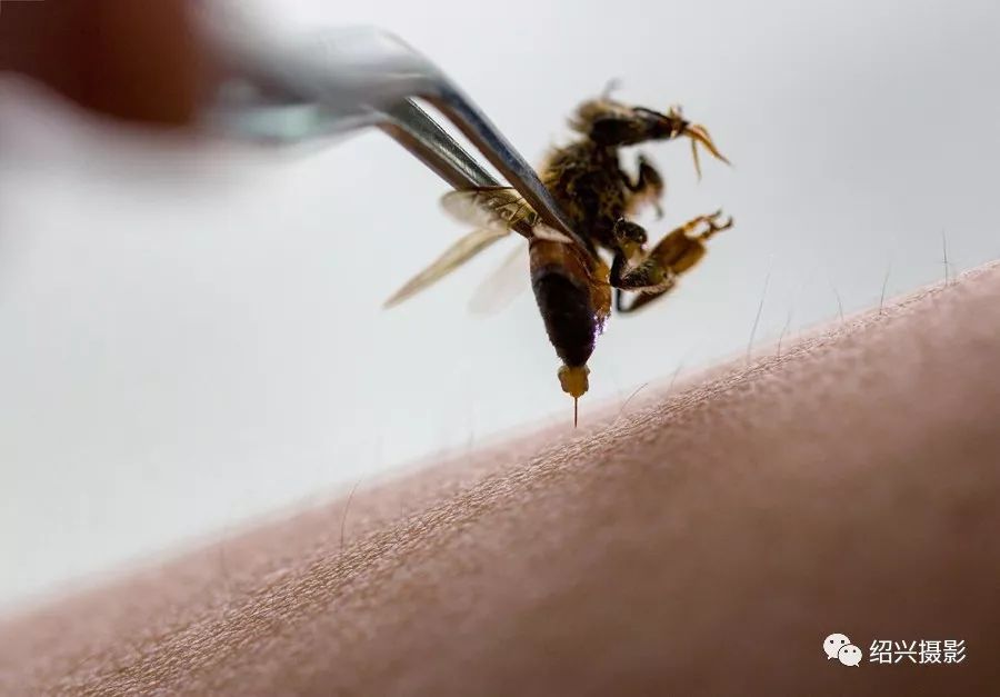 蜂疗:以蜜蜂尾部蛰针为"针具",主要应用于风湿,肿瘤,癌症等疾病rec药