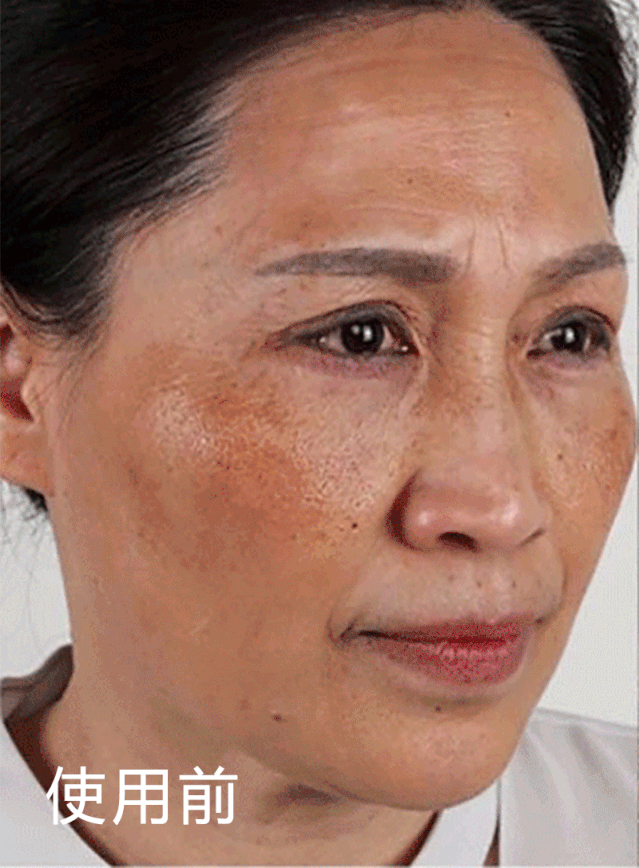 斑点皱纹全没了给肌肤吃颗蛋肌肤就能变白变嫩变紧就这么简单