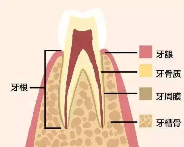 1,糖尿病會增加牙周炎的發病風險及嚴重程度,是牙周炎發生和發展的