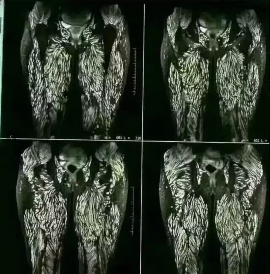 全是因为吃了它,很多人都爱吃_肝吸虫