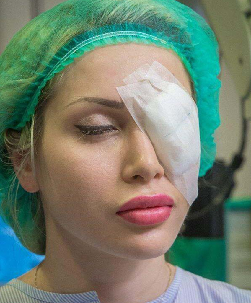 26岁女子疯狂整容全身上下都是整的连眼球都要整