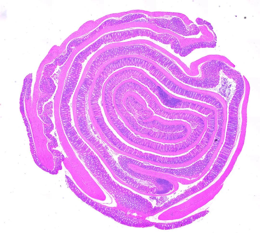 小鼠小肠的显微镜图像表明,a20调节免疫力以增加肠道自身免疫为代价