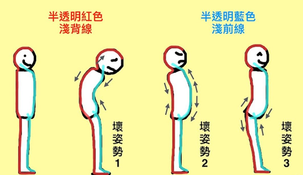 影响你姿势的筋膜平衡浅前线和浅背线