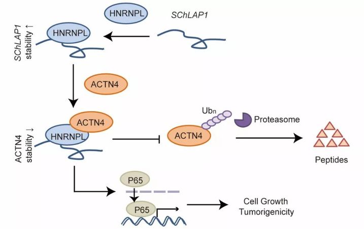 山东大学齐鲁医院：李新钢、王剑教授团队在脑胶质瘤LncRNA领域获新突破_研究