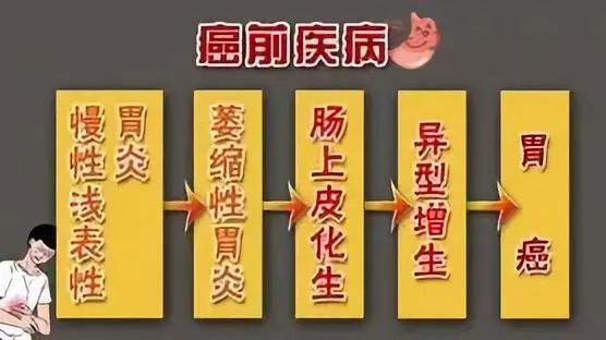 这四种胃型易诱发萎缩性胃炎你中招了吗