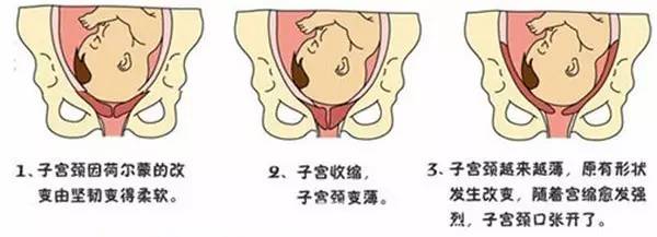 生孩子示意图图片