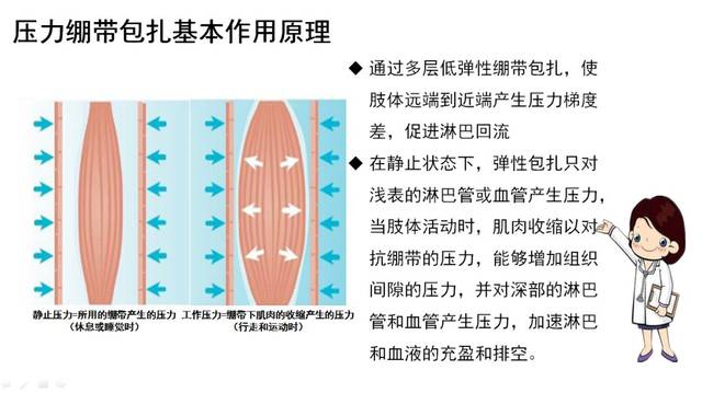 周四讲堂淋巴水肿居家压力治疗