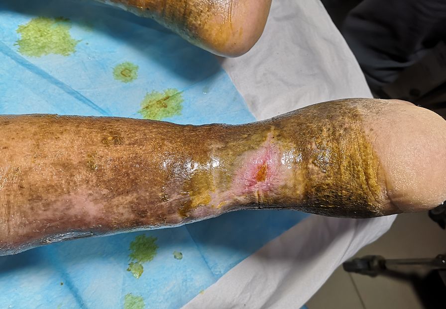 包头这些人可获救助,共1000名!快看有你吗?