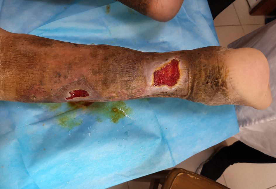 包头这些人可获救助,共1000名!快看有你吗?